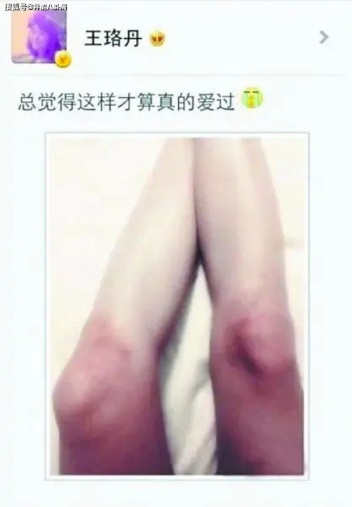 王珞丹膝盖(穿“千层糕鞋”的王珞丹却显腿短，怎样才能把腿“拉长”？)